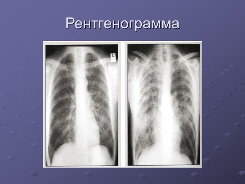 Рентгенограмма